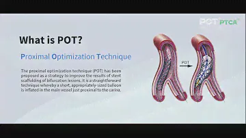 Brosmed POT PTCA Balloon Dilatation Catheter